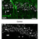 Light-sensitve tagged proteins (top) compared to a control. Credit: MRC Brain Institute